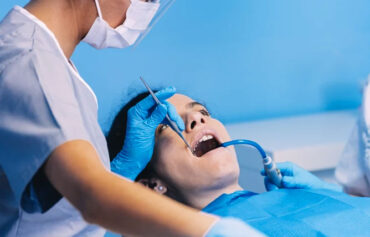 Professional Dental Cleaning/Scaling