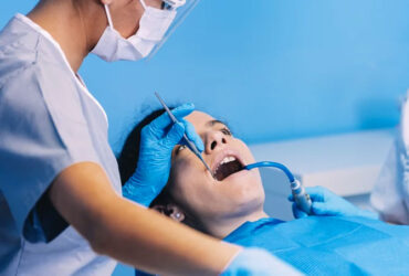 Professional Dental Cleaning/Scaling